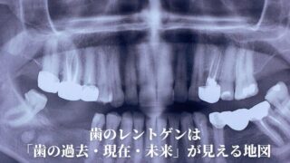 歯科レントゲンは「あなたの歯の過去・現在・未来」が見える地図